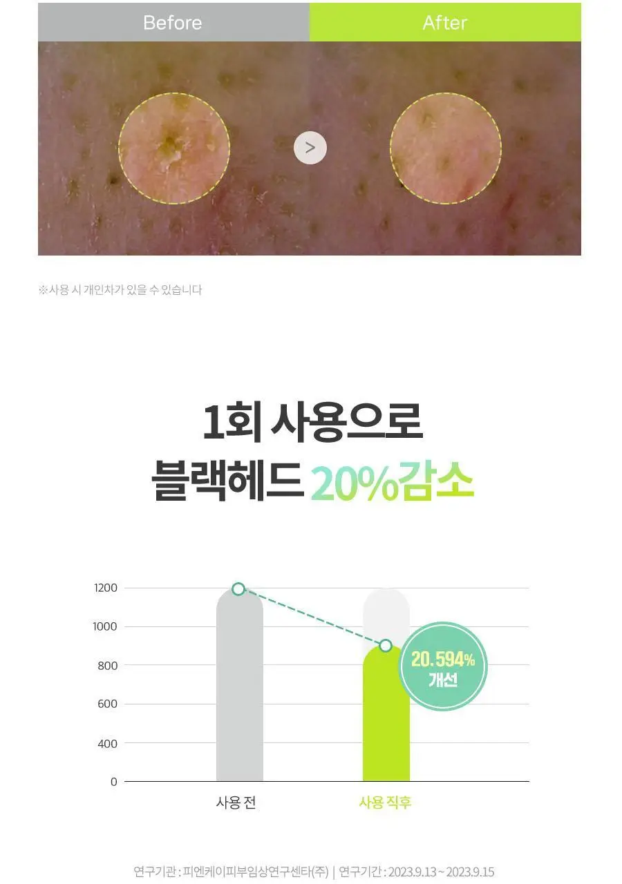 [오일폼 키트 증정 (55g)] 맥스클리닉 히알루론 비타 클렌징 밤 투 오일 90ml 상세페이지 20